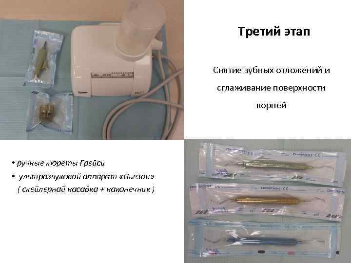 Третий этап Снятие зубных отложений и сглаживание поверхности корней • ручные кюреты Грейси •