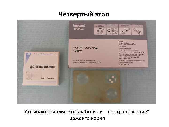 Четвертый этап Антибактериальная обработка и ”протравливание” цемента корня 