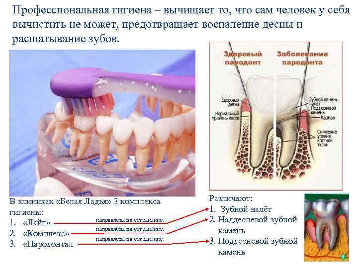 Профессиональная гигиена – вычищает то, что сам человек у себя вычистить не может, предотвращает