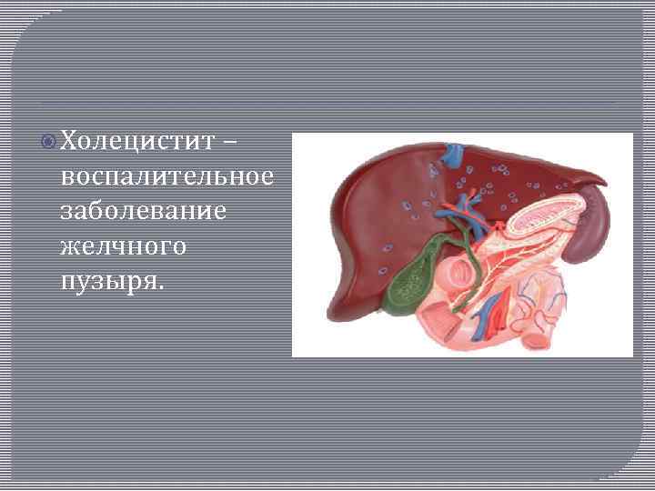  Холецистит – воспалительное заболевание желчного пузыря. 