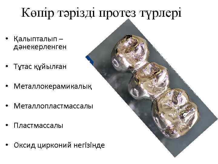 Көпір тәрізді протез түрлері • Қалыпталып – дәнекерленген • Тұтас құйылған • Металлокерамикалық •