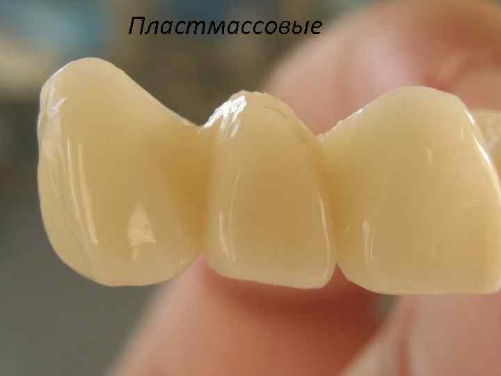 Пластмассовые 