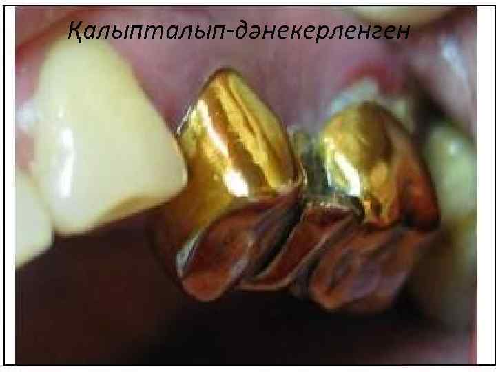 Қалыпталып-дәнекерленген 