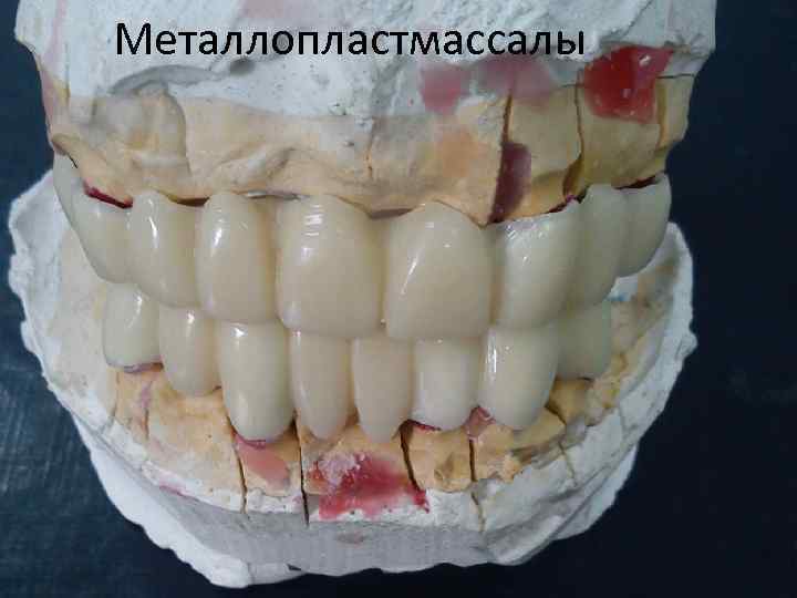 Металлопластмассалы 