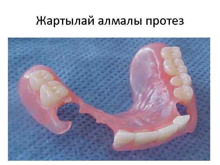 Жартылай алмалы протез 