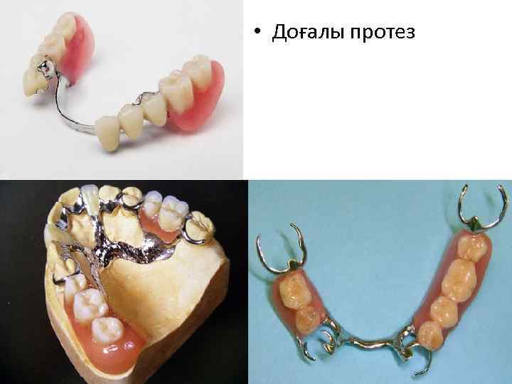  • Доғалы протез 