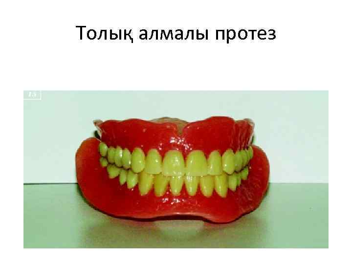 Толық алмалы протез 