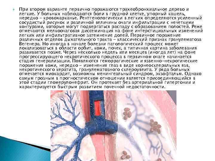 Сосудистый рисунок. Трахеобронхиальное трахеобронхиальное дерево. Клетки трахеобронхиального дерева. Воспаление трахеобронхиального дерева. Острое воспаление трахеобронхиального дерева.