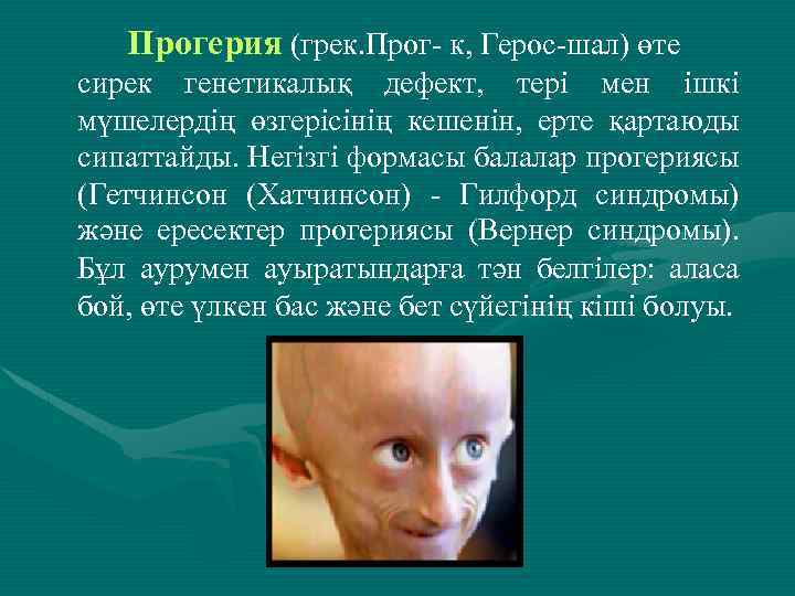 Прогерия (грек. Прог- к, Герос-шал) өте сирек генетикалық дефект, тері мен ішкі мүшелердің өзгерісінің