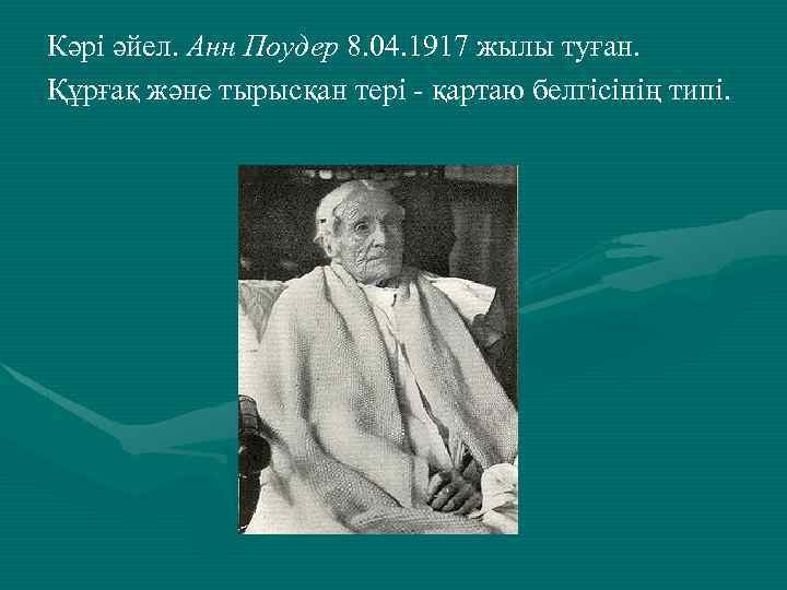 Кәрі әйел. Анн Поудер 8. 04. 1917 жылы туған. Құрғақ және тырысқан тері -