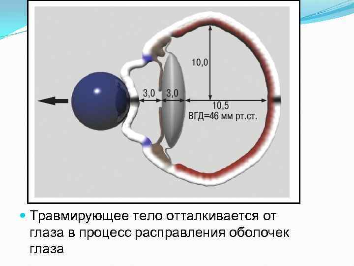  Травмирующее тело отталкивается от глаза в процесс расправления оболочек глаза 
