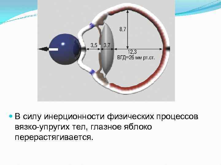  В силу инерционности физических процессов вязко упругих тел, глазное яблоко перерастягивается. 