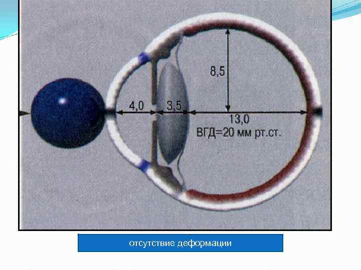 отсутствие деформации 