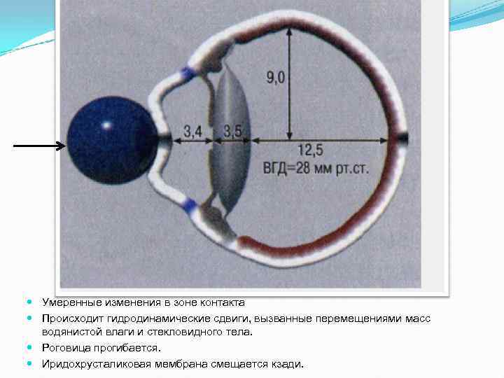  Умеренные изменения в зоне контакта Происходит гидродинамические сдвиги, вызванные перемещениями масс водянистой влаги