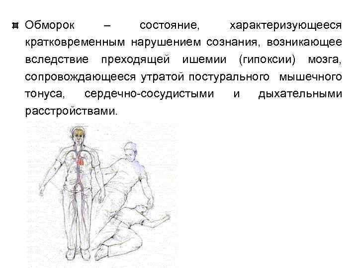 Обморок – состояние, характеризующееся кратковременным нарушением сознания, возникающее вследствие преходящей ишемии (гипоксии) мозга, сопровождающееся