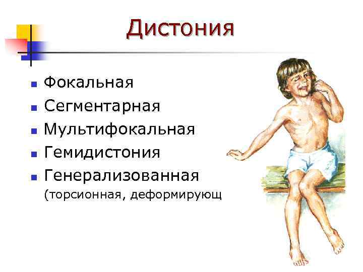 Дистония n n n Фокальная Сегментарная Мультифокальная Гемидистония Генерализованная (торсионная, деформирующая) 