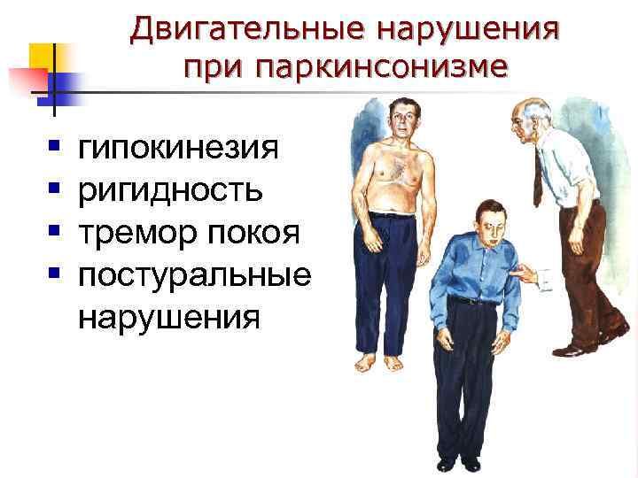 Двигательные нарушения при паркинсонизме § § гипокинезия ригидность тремор покоя постуральные нарушения 