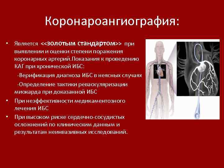 Коронароангиография: • Является <<золотым стандартом>> при выявлении и оценки степени поражения коронарных артерий. Показания