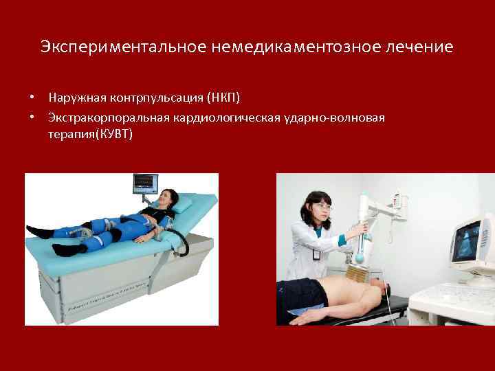 Экспериментальное немедикаментозное лечение • Наружная контрпульсация (НКП) • Экстракорпоральная кардиологическая ударно-волновая терапия(КУВТ) 