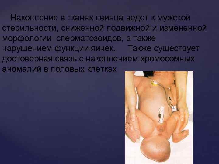 Накопление в тканях свинца ведет к мужской стерильности, сниженной подвижной и измененной морфологии сперматозоидов,