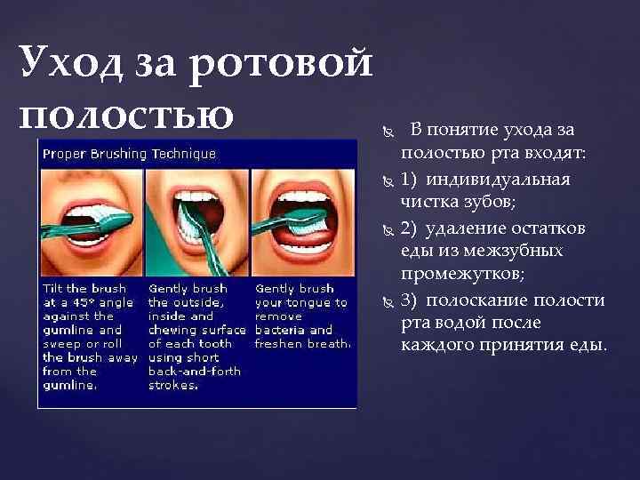 Уход за ротовой полостью В понятие ухода за полостью рта входят: 1) индивидуальная чистка