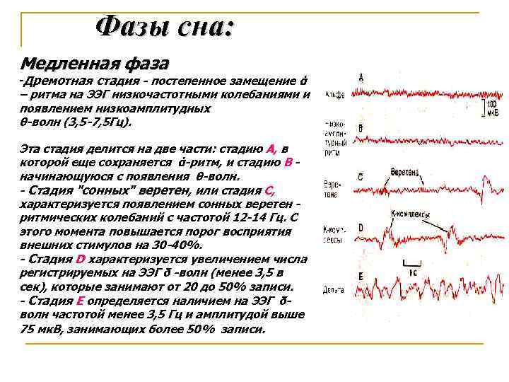 Фазы сна пьяного