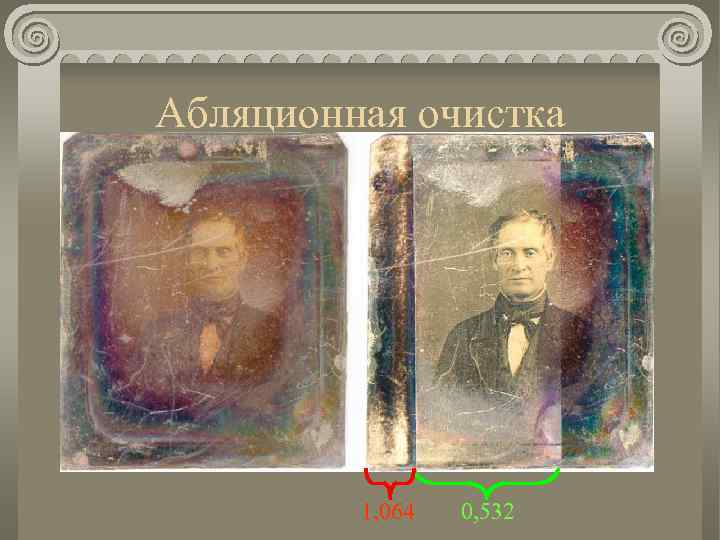 Абляционная очистка 1, 064 0, 532 