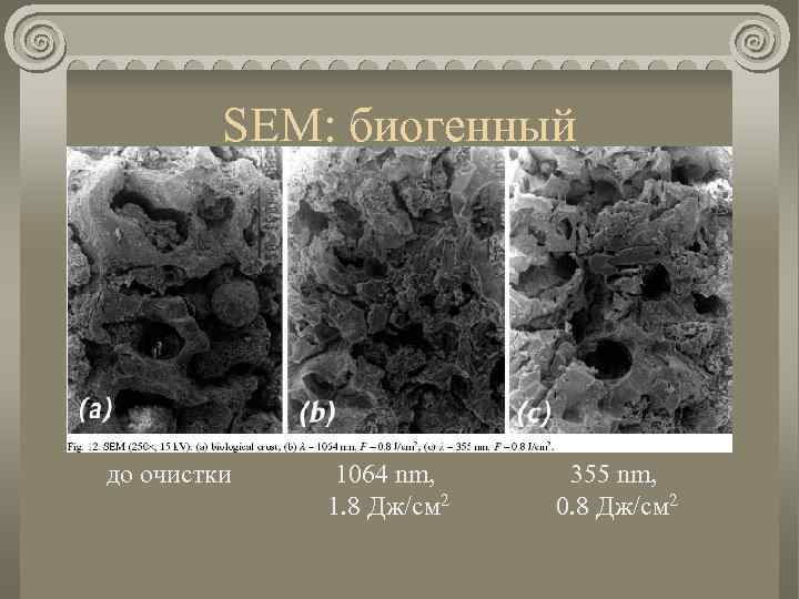 SEM: биогенный до очистки 1064 nm, 1. 8 Дж/см 2 355 nm, 0. 8