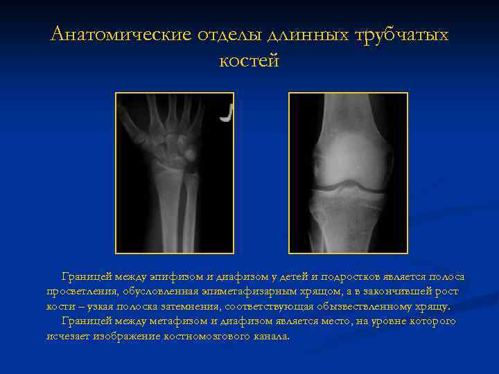 Анатомические отделы длинных трубчатых костей Границей между эпифизом и диафизом у детей и подростков