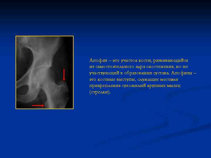 Апофиз – это участок кости, развивающийся из самостоятельного ядра окостенения, но не участвующий в