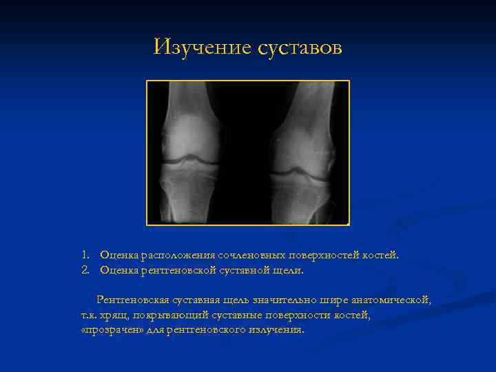 Изучение суставов 1. Оценка расположения сочленовных поверхностей костей. 2. Оценка рентгеновской суставной щели. Рентгеновская