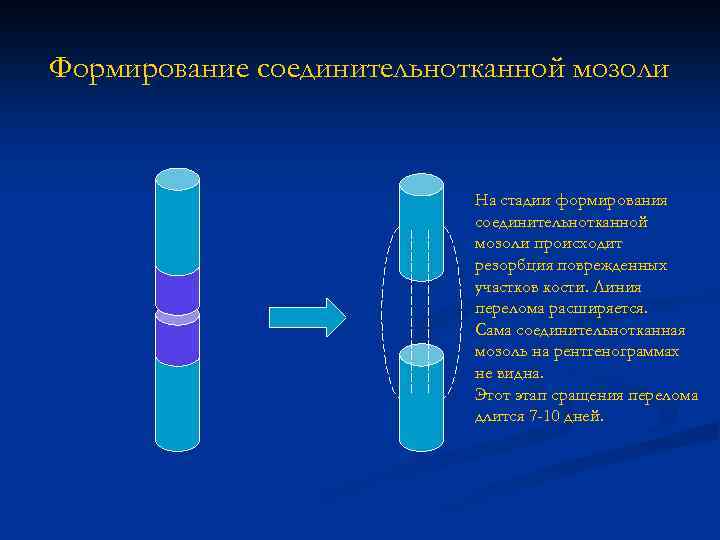 Формирование соединительнотканной мозоли На стадии формирования соединительнотканной мозоли происходит резорбция поврежденных участков кости. Линия