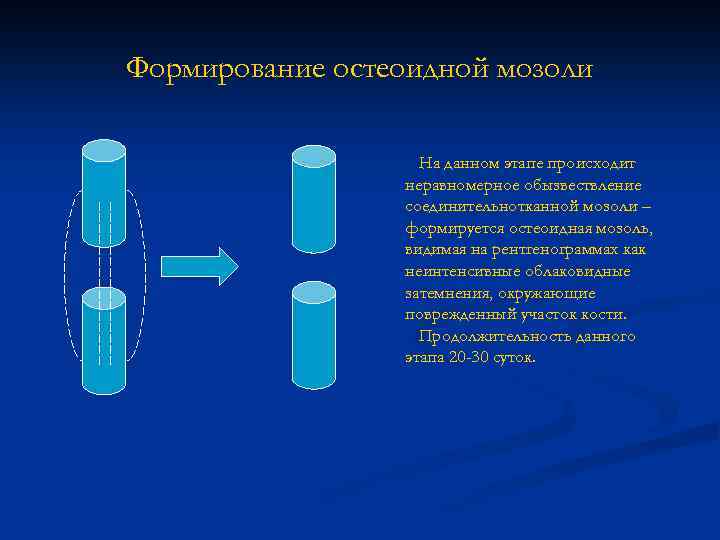 Формирование остеоидной мозоли На данном этапе происходит неравномерное обызвествление соединительнотканной мозоли – формируется остеоидная