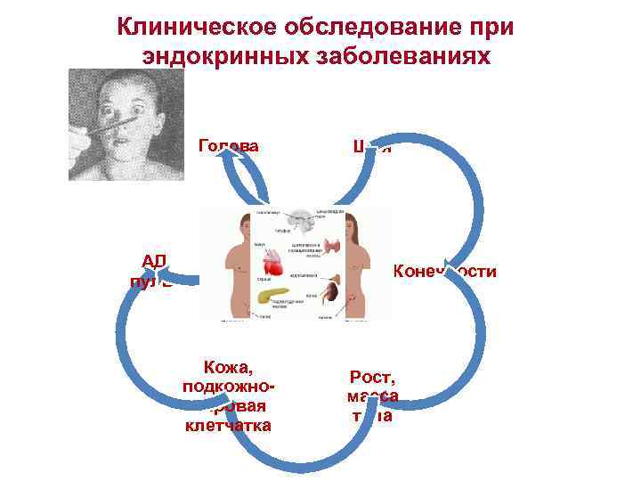 Клиническое обследование при эндокринных заболеваниях Голова АД, пульс Кожа, подкожножировая клетчатка Шея Конечности Рост,