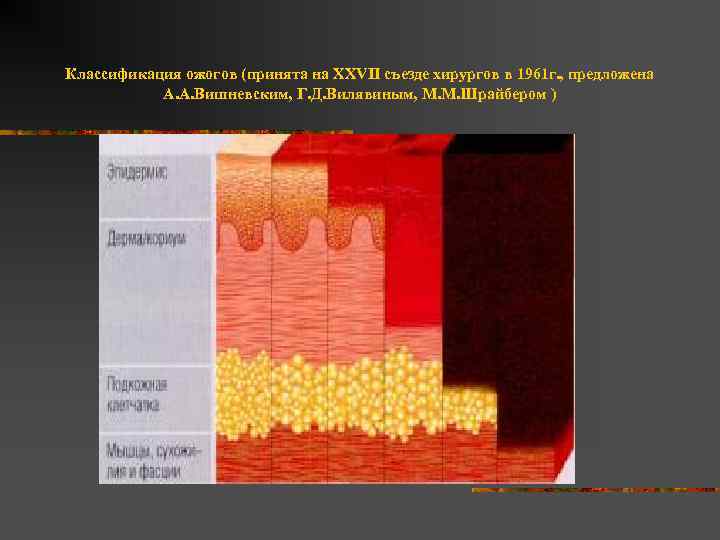 Классификация ожогов (принята на XXVII съезде хирургов в 1961 г. , предложена А. А.