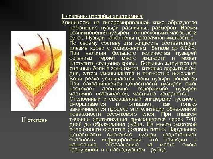 II степень- отслойка эпидермиса Клинически на гиперемированной коже образуются небольшие пузыри различных размеров. Время