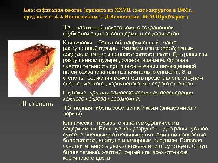 Классификация ожогов (принята на XXVII съезде хирургов в 1961 г. , предложена А. А.