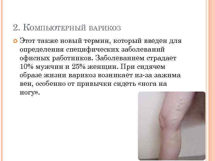 2. КОМПЬЮТЕРНЫЙ ВАРИКОЗ Этот также новый термин, который введен для определения специфических заболеваний офисных