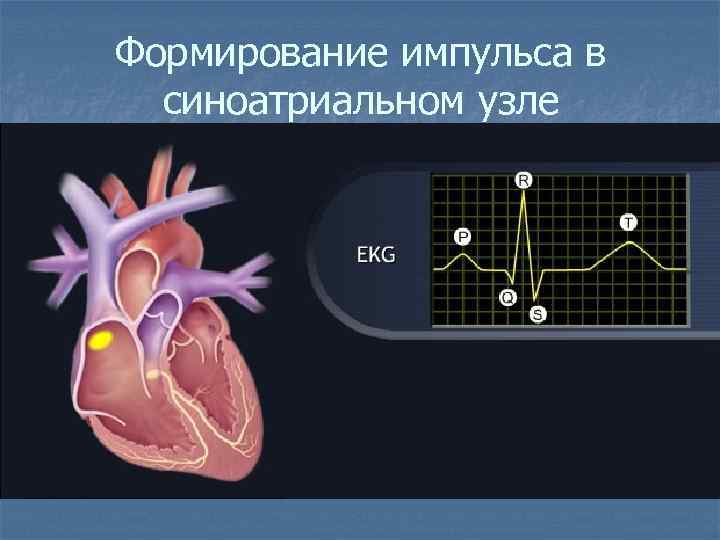 Формирование импульса в синоатриальном узле 