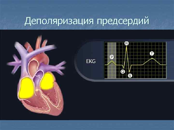 Деполяризация предсердий 