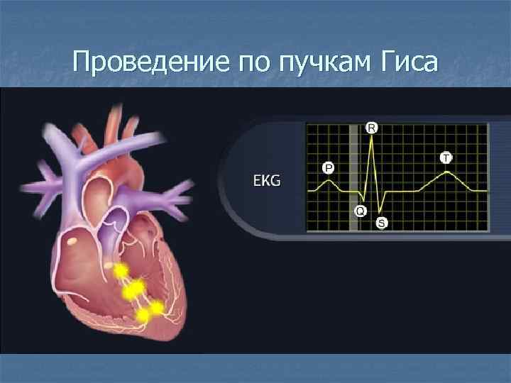 Проведение по пучкам Гиса 