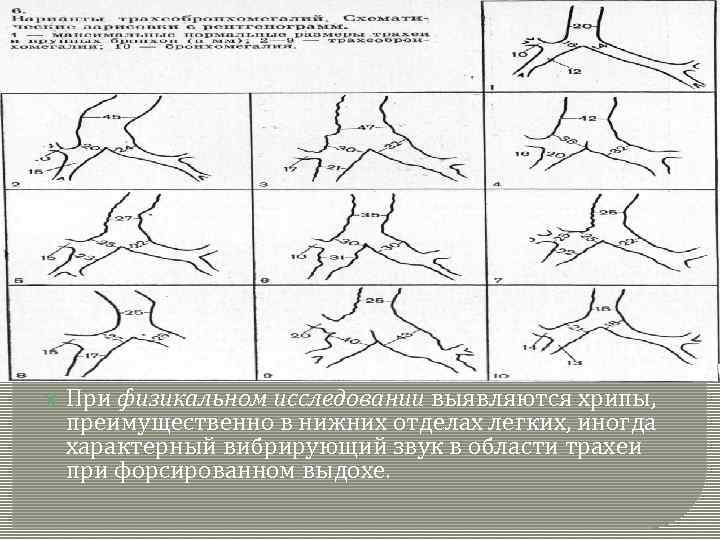  При физикальном исследовании выявляются хрипы, преимущественно в нижних отделах легких, иногда характерный вибрирующий