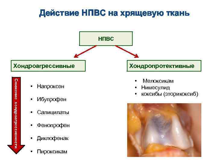 Действие НПВС на хрящевую ткань НПВС Хондроагрессивные Снижение хондроагрессивности • Напроксен • Ибупрофен •