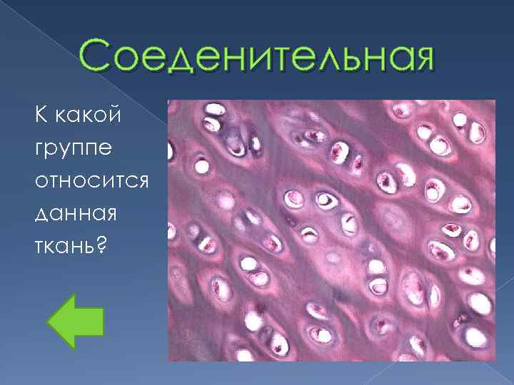 Соеденительная К какой группе относится данная ткань? 