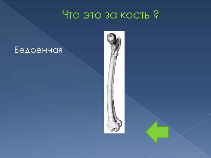 Что это за кость ? Бедренная 