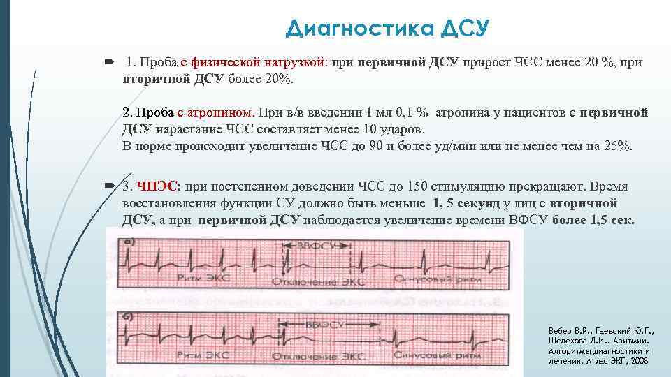 Диагностика ДСУ 1. Проба с физической нагрузкой: при первичной ДСУ прирост ЧСС менее 20