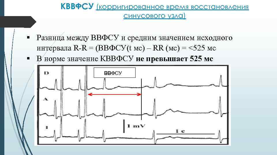 КВВФСУ (корригированное время восстановления синусового узла) § Разница между ВВФСУ и средним значением исходного