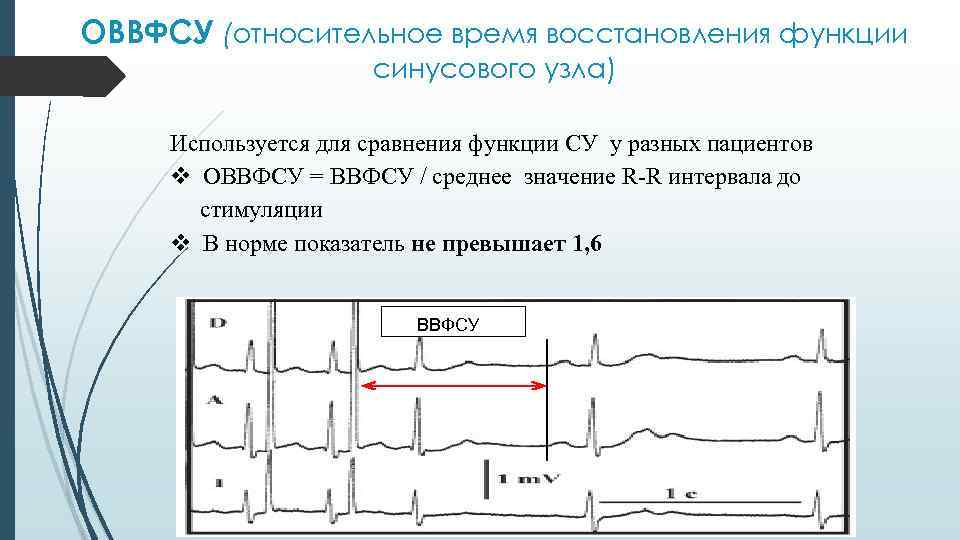 ОВВФСУ (относительное время восстановления функции синусового узла) Используется для сравнения функции СУ у разных
