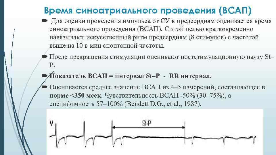 Время синоатриального проведения (ВСАП) Для оценки проведения импульса от СУ к предсердиям оценивается время