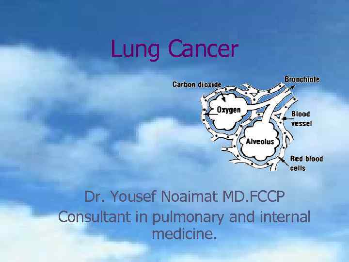 Lung Cancer Dr. Yousef Noaimat MD. FCCP Consultant in pulmonary and internal medicine. 